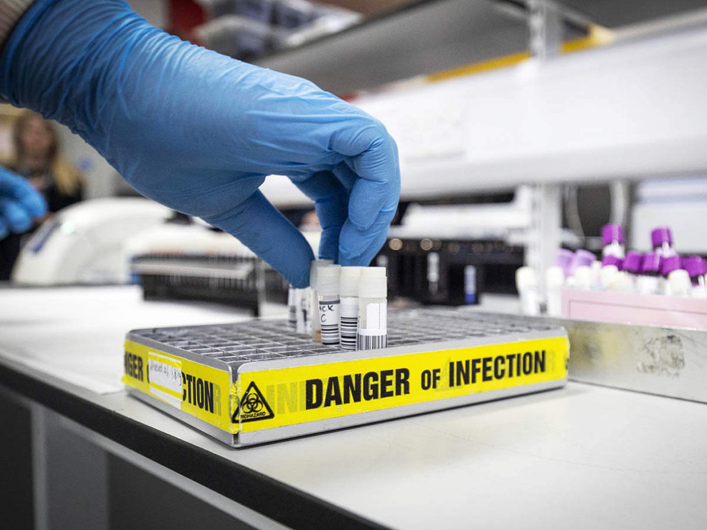 Chinese counter against Aussies signs to countries preferring Wuhan lab test. 