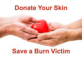 Rajkot woman's 'skin donation'.