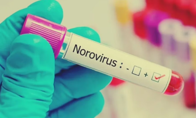 norovirus