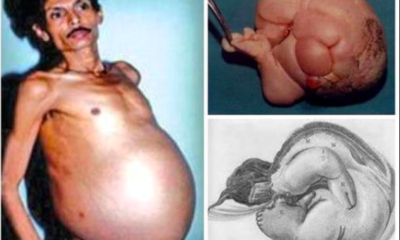 Met a pregnant Man from Nagpur Maharashtra