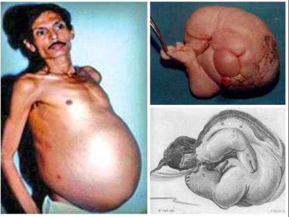 Met a pregnant Man from Nagpur Maharashtra