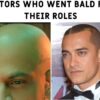 Actors who went bald