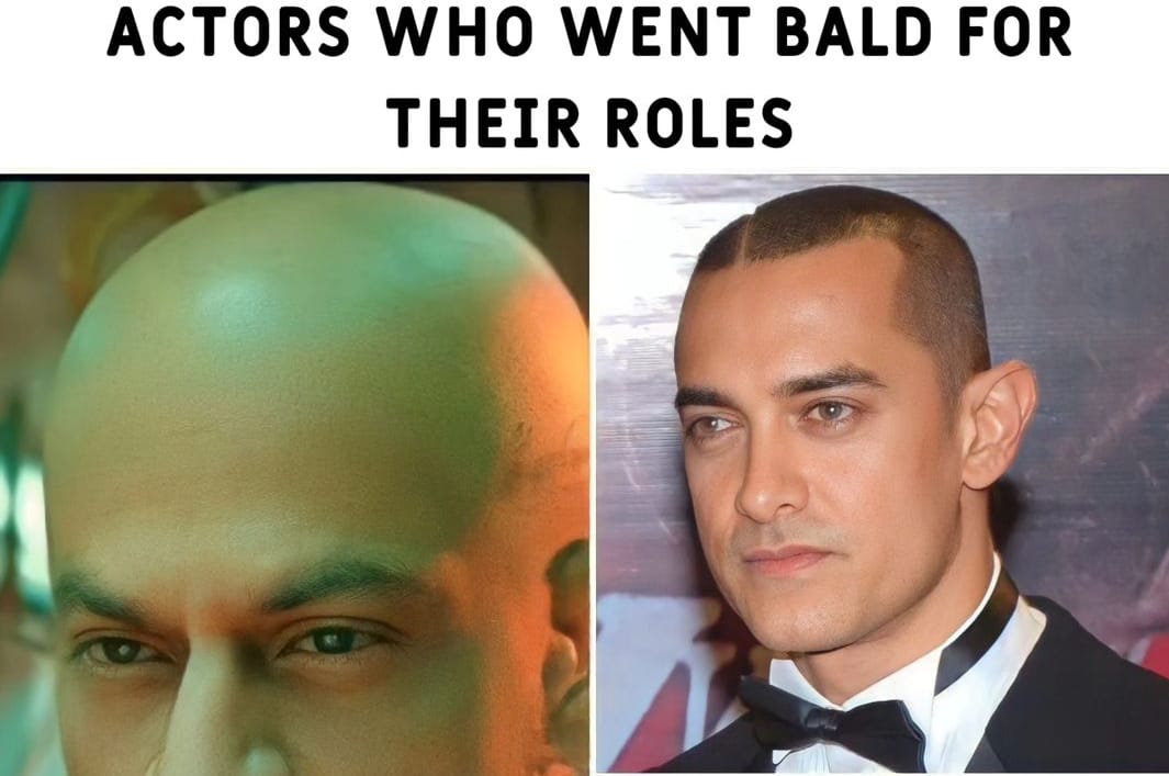 Actors who went bald