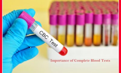 cbc tests