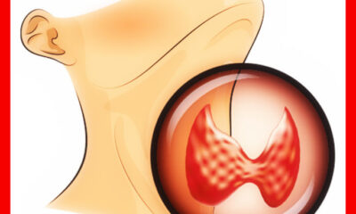 thyroid function test Indian daily post