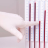 The ESR test, or ESR blood test, measures inflammation by measuring how quickly red blood cells settle in a tube.