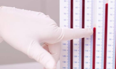 The ESR test, or ESR blood test, measures inflammation by measuring how quickly red blood cells settle in a tube.