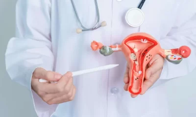 Polycystic Ovary Syndrome (PCOS) is a common hormonal disorder that affects women of reproductive age.