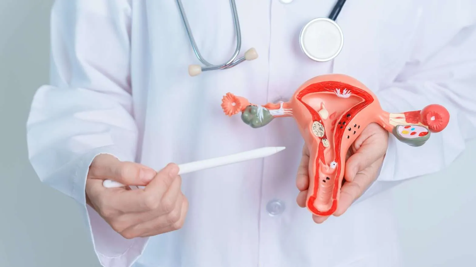 Polycystic Ovary Syndrome (PCOS) is a common hormonal disorder that affects women of reproductive age.